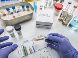 Novel coronavirus 2019 nCoV pcr diagnostics kit. This is RT-PCR kit